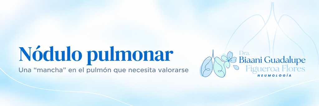 Nódulo pulmonar - Dra. Biaani Figueroa, neumóloga en Tuxtla Gutiérrez